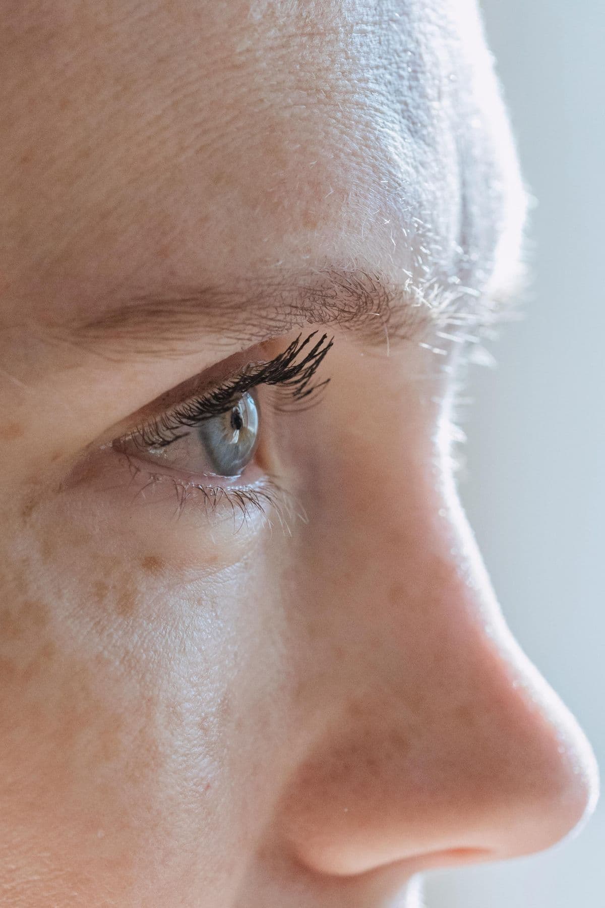 Can Botox® and Similar Products Improve the Appearance of Scars?